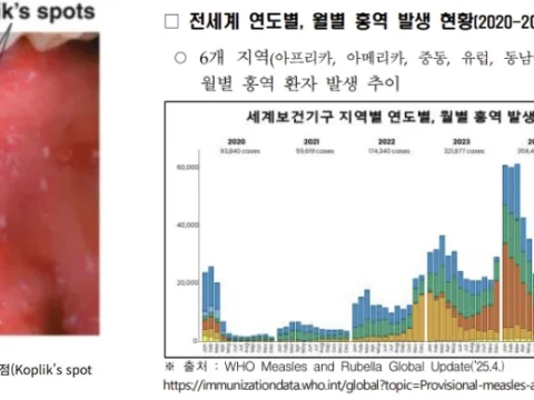 홍역 확산, 백신 접종률, 해외여행 감염, MMR 백신, 질병관리청, WHO, 풍토병, 홍역 예방, 발열 발진 증상, 감염병 유행