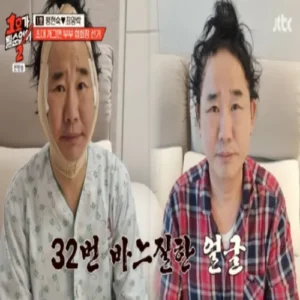 최양락, 성형 폭로에 “난 대머리 아냐…의학의 힘은 마술”